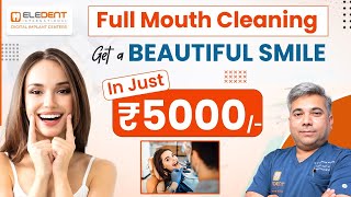 Smile Brighter with Full Mouth Cleaning for ₹5000 in Eledent | Full Mouth Cleaning | Teeth Cleaning