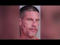 Police: Florida man calls 911 to report himself drunk driving