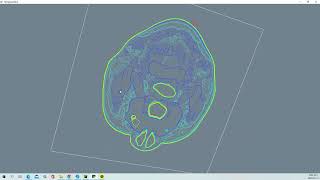 VTK Python Example - FlyingHeadSlice