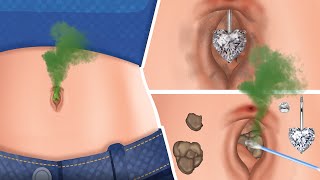ASMR How to best treatment and clean navel piercings, navel stones | 현실적인 케어 트리트먼트 애니메이션 2023