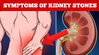 8 Common Signs And Symptoms Of Kidney Stones