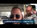 We Grow Hair Indy Hair Transplants