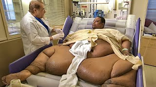 Can You Guess His Weight? Most Overweight People in the World
