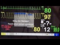 Patient Monitor Tutorial