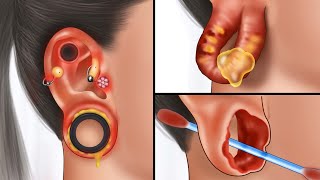 ASMR Popping pustules for big hole swollen ear piercing | Body modification animation