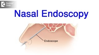 What does a nasal endoscopy look for? - Dr. Harihara Murthy