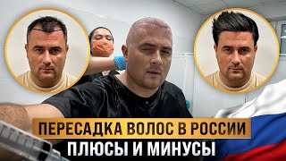 ПЕРЕСАДКА ВОЛОС В РОССИИ, ПЛЮСЫ И МИНУСЫ!