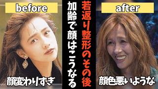 【ガルちゃん】若返り整形の“その後”…加齢でどうなった!?劇的ビフォーアフター【有益2ch】