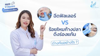 ฟิลเลอร์ร่องแก้ม กับ ร้อยไหมก้างปลาดึงร่องแก้ม ต่างกันอย่างไร? l หมอ V Square แชร์หมดเปลือก