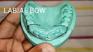 How To Make Labial Bow | Easy Method | Hawley's Retainer