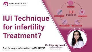 IUI Techniques For Infertility Treatment
