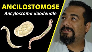 Ancilostomose ou Amarelão (Ancylostoma): ciclo, sintomas e diagnóstico | Curso de #Parasitologia