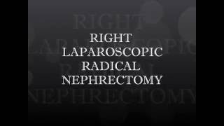 RT LAPAROSCOPIC RADICAL NEPHRECTOMY BY DR SHYAM VARMA