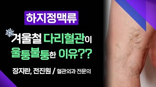 좌식 생활을 하는 분들 주목! 내 다리에 울퉁불퉁한 혈관이 보인다면 혈액순환이 제대로 안되고 있다는 신호입니다 [ 부산MBC 메디컬다큐365 ] 230130 방송