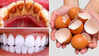 After 1 minute the yellow color of the TEETH becomes PEARL WHITE and shiny 😁✨Removes tartar