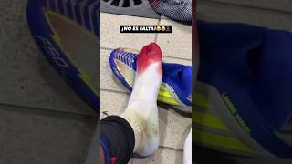 Lamine Yamal’s foot after the game against Las Palmas 🩸😳