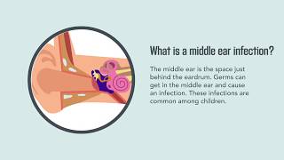 Middle Ear Infections in Children | Merck Manual Consumer Version Quick Facts