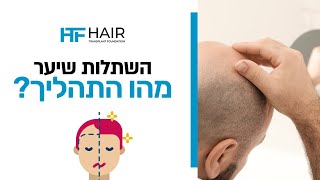 מהו תהליך השתלת שיער?