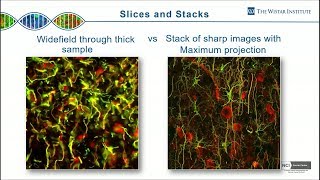 James Hayden -  2-Photon Microscopy: How Deep Can You Go? Part 1