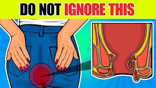 9 Warning Signs Of COLON CANCER  You Should Not Ignore