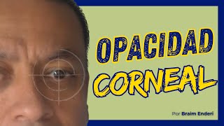 Como se trata la OPACIDAD CORNEAL, síntomas y remedios sobre este padecimiento.