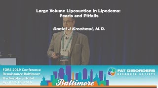 Large Volume Liposuction in Lipedema  Pearls and Pitfalls - Daniel J Krochmal, MD