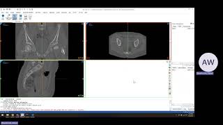Setup Scripting in Materialise Mimics
