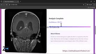 Final Year Project - Brain Tumor Classification Using Deep Learning Model (Python , Flask)