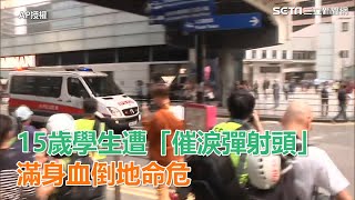 港人反抗／15歲中學生遭「催淚彈射頭」！滿身血倒地命危｜三立新聞網SETN.com