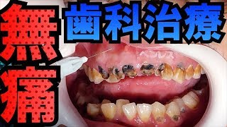 【無痛】歯科治療恐怖症の方のための無痛麻酔[dentistry][ health and wellness][cleaning](針對有齒科治療恐懼癥的患者的無痛麻醉)