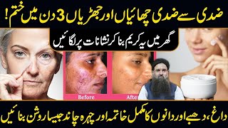 How To Remove Pigmentation From Face Naturally at Home in Urdu | Chaiyon Ka ilaj Dr Sharafat Ali