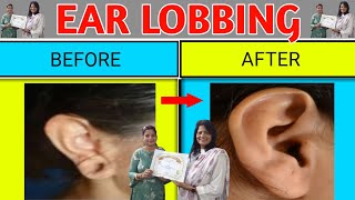 How to fix earlobe holes | घर बैठे कान के छेद को कैसे ठीक करें | ear lobbing treatment