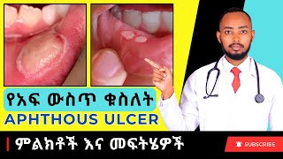 Ethiopia | የአፍ ውስጥ ቁስለት (Aphthous ulcer) መፍትሄዎች