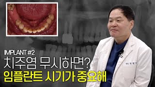 만성치주염! 치료 시기를 놓치면 안돼요ㅣ임플란트 사례