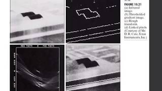 Hoge Detection Image Processing Unit 4 Part 2