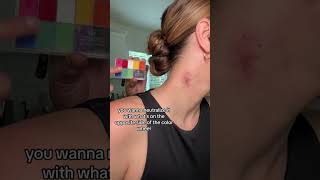How to get rid of a hickey on your neck instantly by covering with makeup and green color corrector