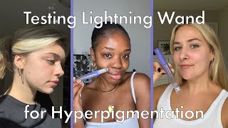 Trying Lightning Wand for Hyperpigmentation | Hero Cosmetics