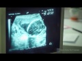 ultrasound 20 weeks 5 months pregnant it s a girl