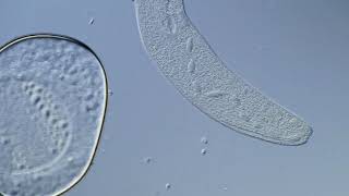 Spirostomum ambiguum - Giant Ciliate under a Microscope (DIC)