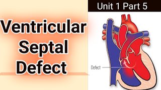ventricular septal defect | vsd | pathophysiology, symptoms and surgical treatment of VSD.