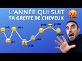 La Greffe de Cheveux va t'énerver 🤬 - Joie, Blues, inquiétudes... T'es Prévenu!