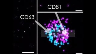 Duncan Ross PhD: Advancements in Kimera Exosome Characterization