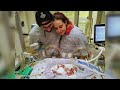 Riley Children's Hospital gives 'micro-preemie' a new chance at life