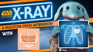 Skeleton Crew - Episode Seven LIVE Discussion with Stardust Records - X-Ray