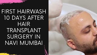 First Hair wash 10 days after Hair Transplant Surgery in Navi Mumbai