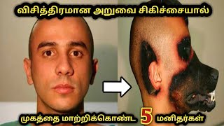 விசித்திரமாக அறுவை சிகிச்சை செய்துகொண்ட 5 மனிதர்கள்...