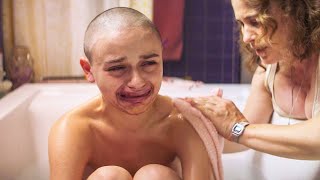 Too Beautiful, Mom Makes Her Ugly By Faking Her Cancer To Avoid Boys