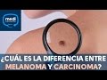 ¿Cuál es la diferencia entre melanoma y carcinoma? #MediConsultas