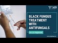 Black fungus Treatment with antifungals | Dr. K. R. Meghanadh| Medyblog