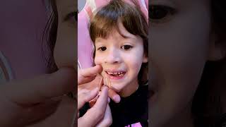 Lost another milk tooth 🦷